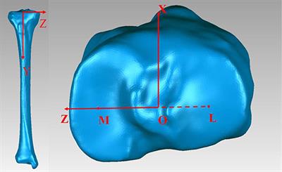 A New Reference Axis for Tibial Component Rotation in Total Knee Arthroplasty: A Three-dimensional Computed Tomography Analysis